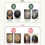 【薄毛、抜け毛でお悩みのお客様】AGAメディカルクリニックと提携を開始しました